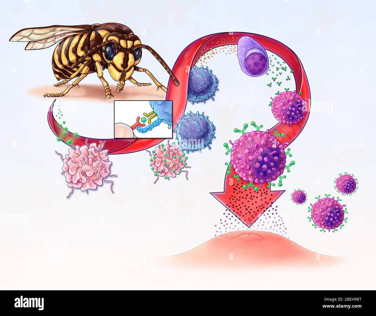 Sviluppo di allergia, illustrazione Foto Stock