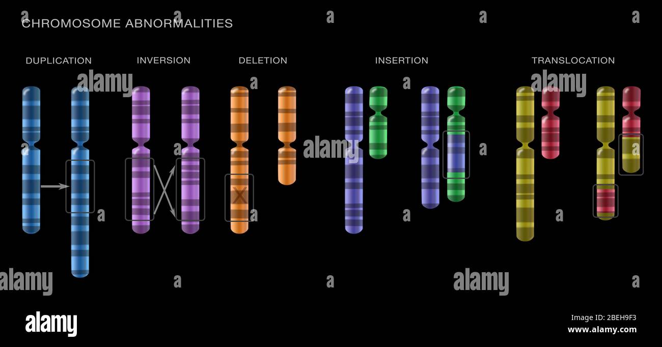 Anomalie cromosomiche, illustrazione Foto Stock