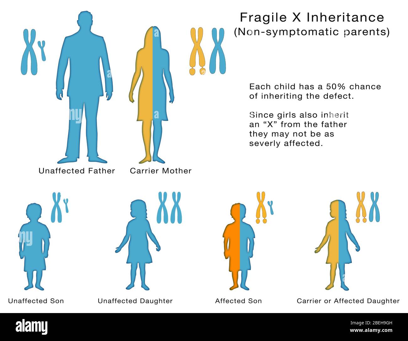 Eredità X fragile, illustrazione Foto Stock