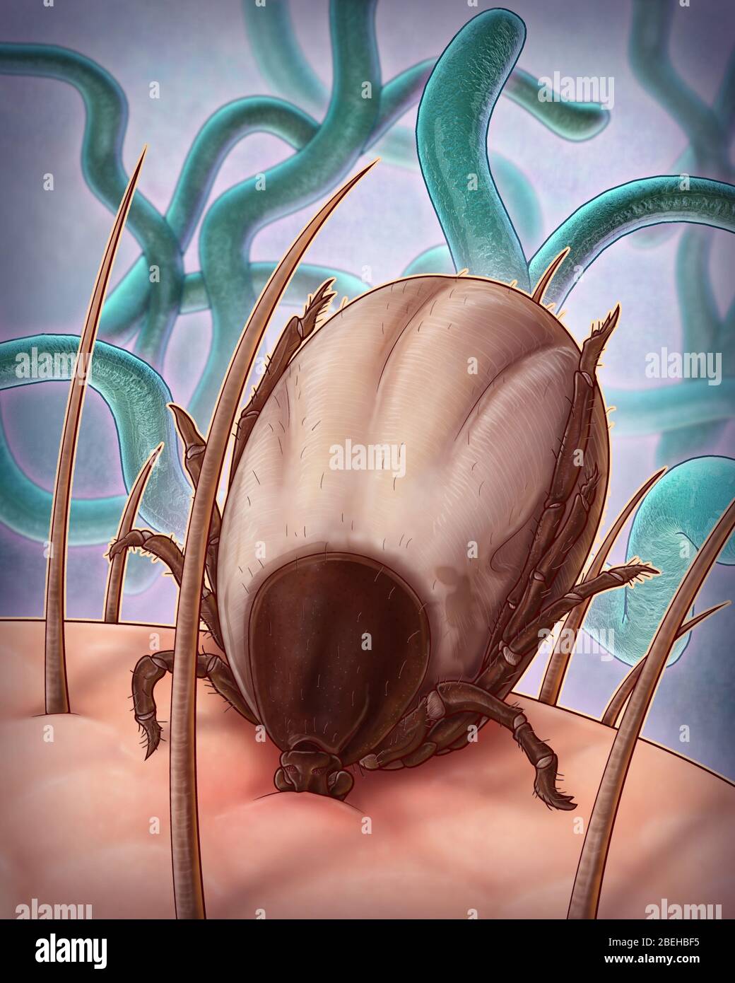 Malattia di Lyme, illustrazione Foto Stock