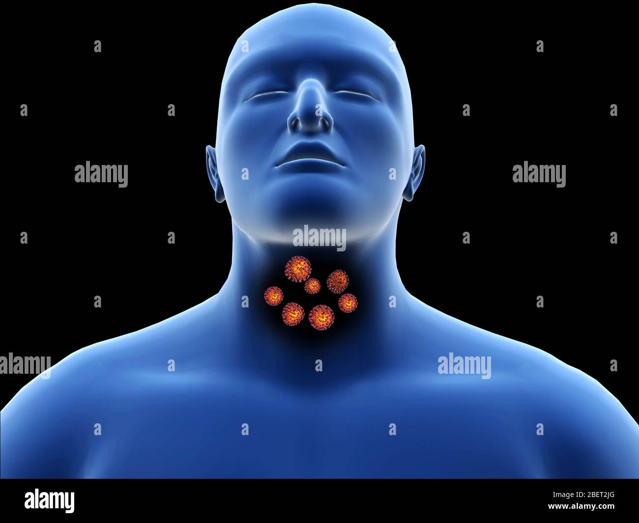 Concetto illustrativo di coronavirus nella gola umana, prima di entrare nei polmoni. Foto Stock