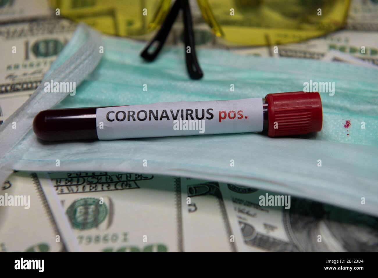 La situazione economica del mondo e il test positivo al coronavirus. Foto Stock