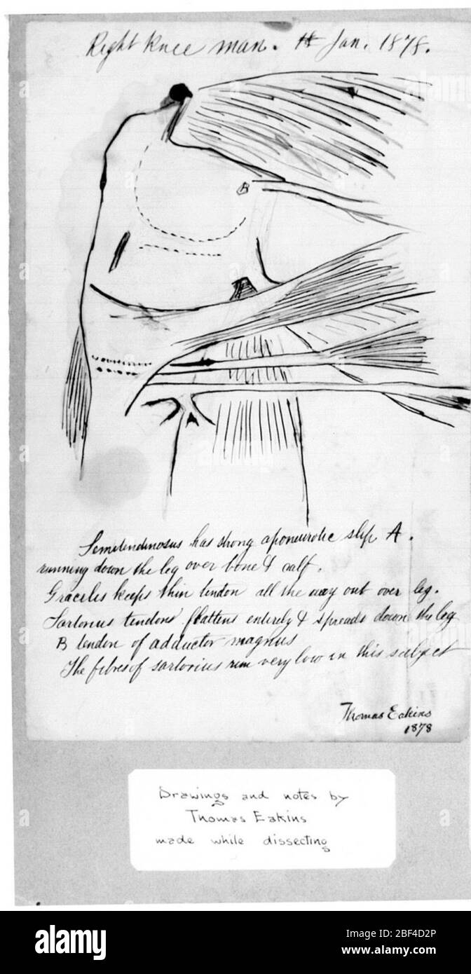 Studio anatomico senza titolo del ginocchio destro. JH acquistato da Knoedler & Co., Inc., M., New York 1961 Foto Stock