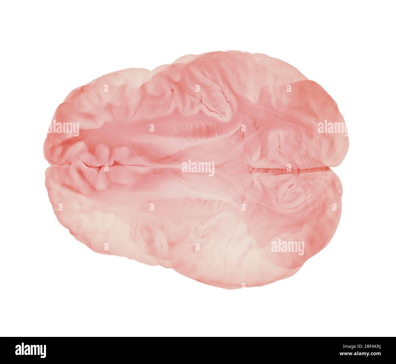 Sezione orizzontale attraverso emisferi cerebrali. Anatomia cerebrale umana Foto Stock
