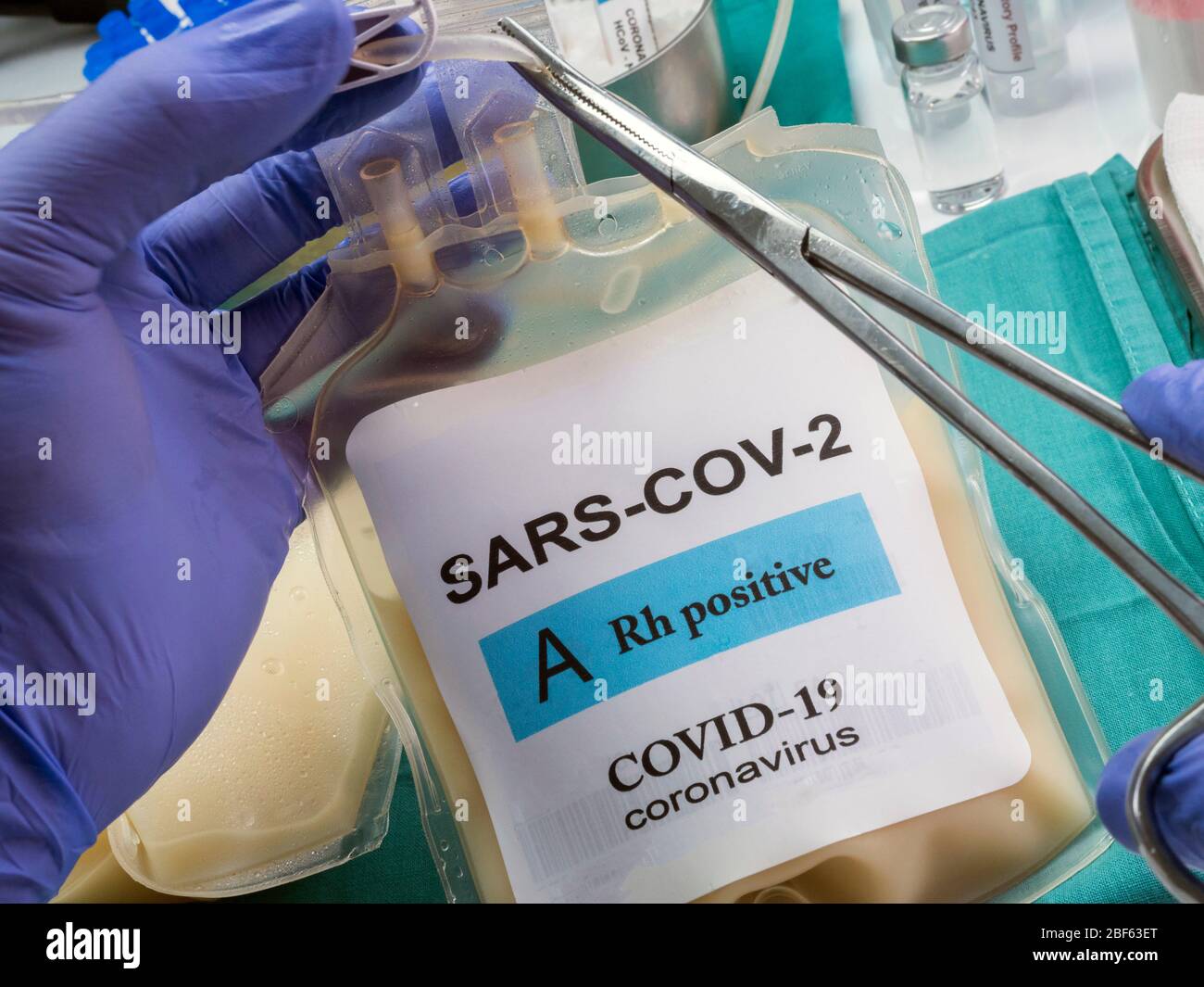 Sacca per plasma con anticorpi da persone curate di SARS-COV-2 Covid-19 preparata in un'immagine concettuale ospedaliera Foto Stock