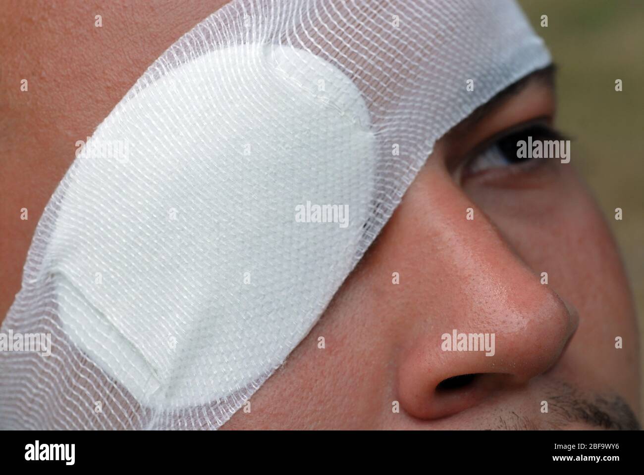 Un uomo che indossa un cerotto. Oltre ad essere usato per trattare una lesione, le zone dell'occhio possono anche essere usate per trattare un occhio pigro. Foto Stock