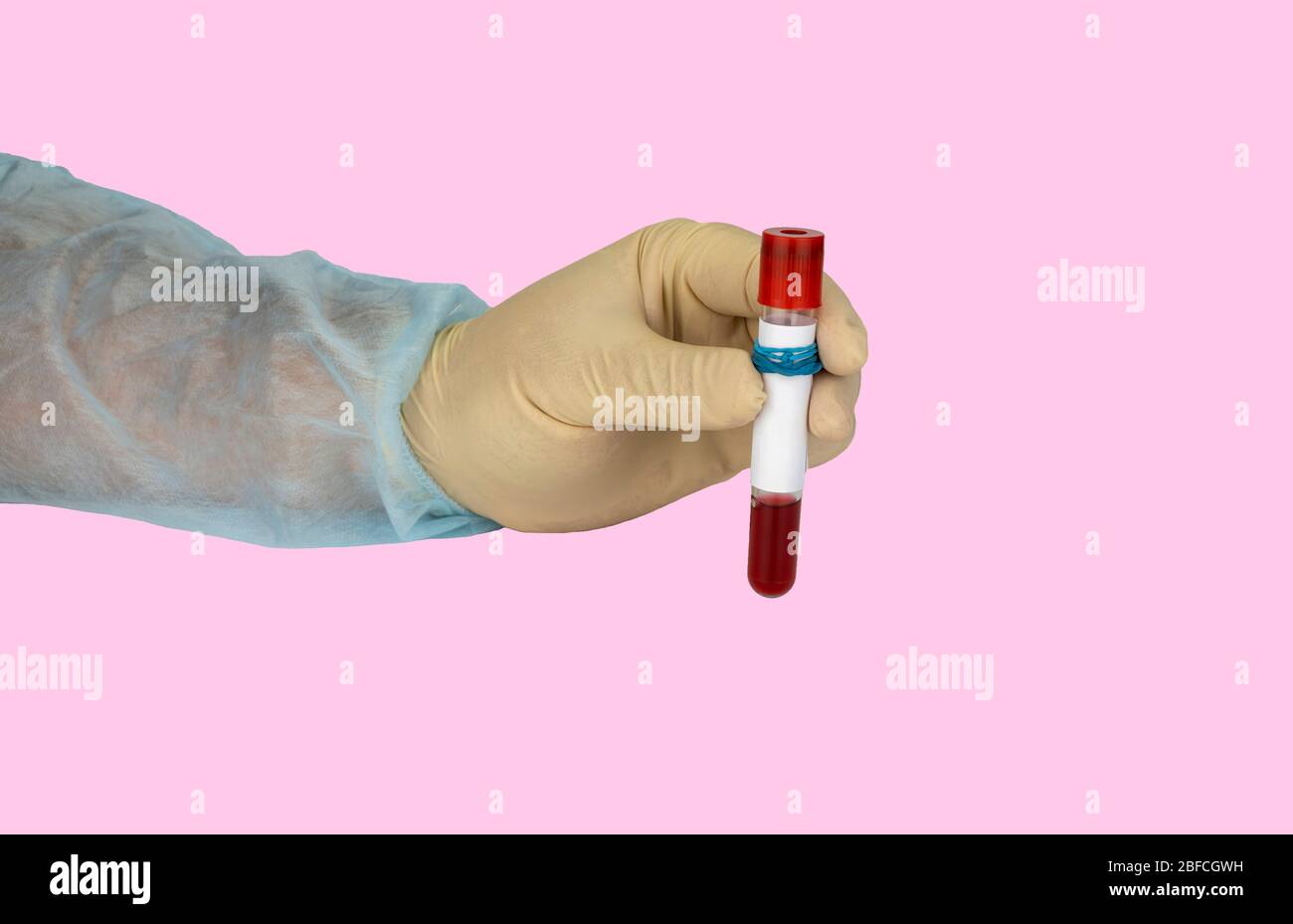 Mano che trattiene il campione di sangue in una provetta sottovuoto. Risultato positivo del test per il nuovo Coronavirus a rapida diffusione Foto Stock