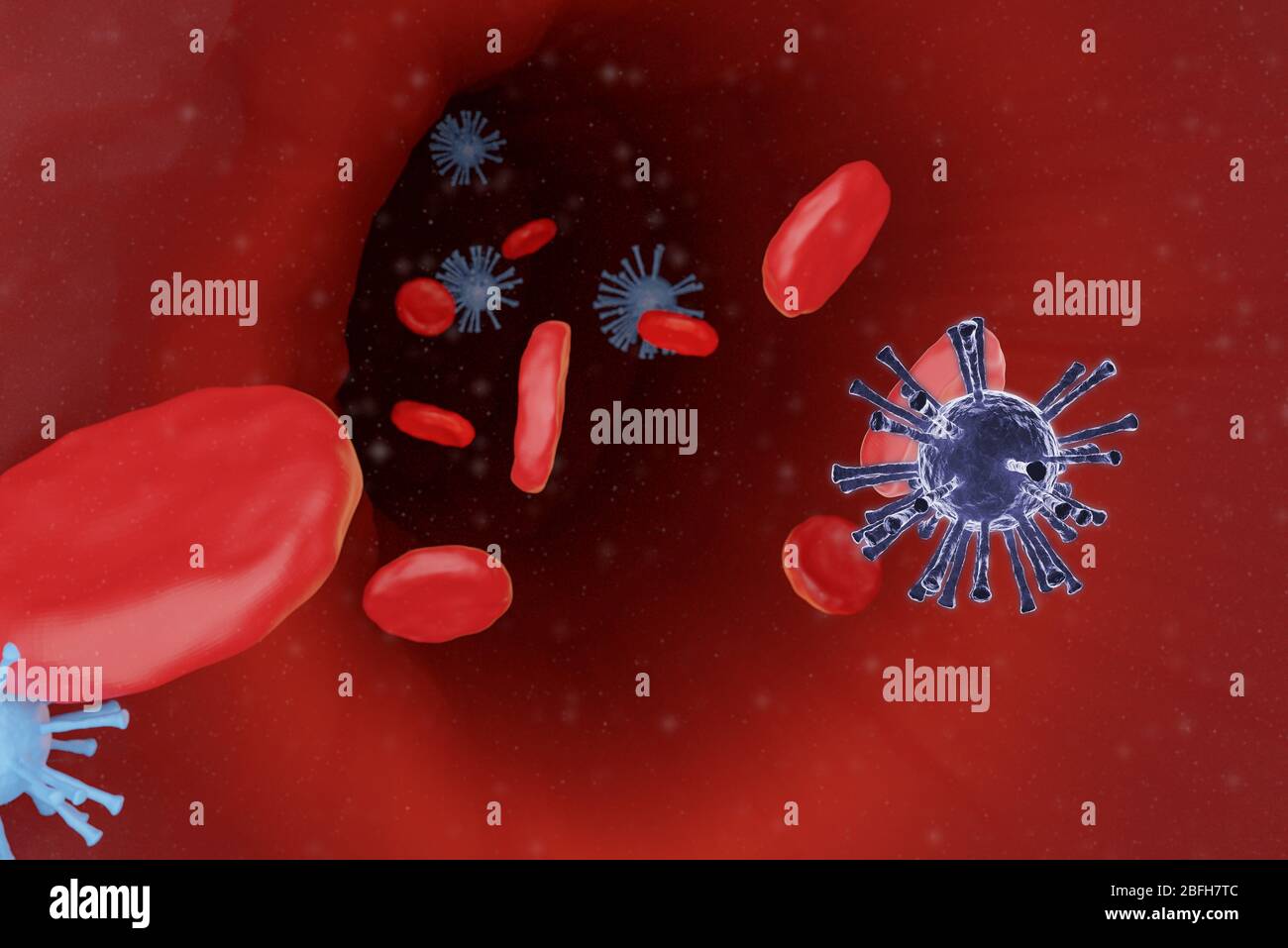 Globuli rossi nell'arteria di alimentazione del sangue con focolaio di virus, rappresentazione grafica 3D Foto Stock