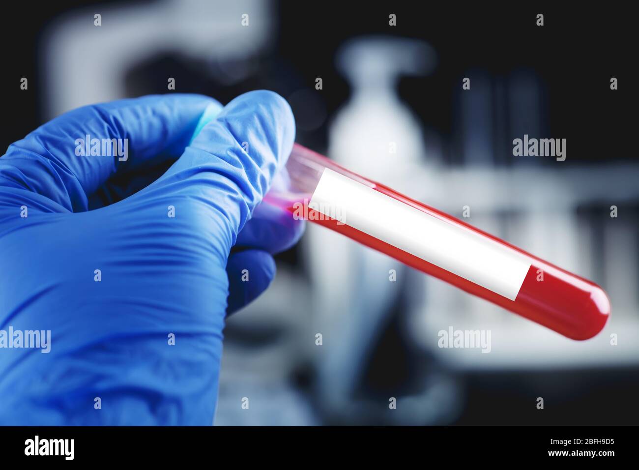 Mano di un medico che tiene un flacone di campione di sangue. L'epidemia di coronavirus. Foto Stock