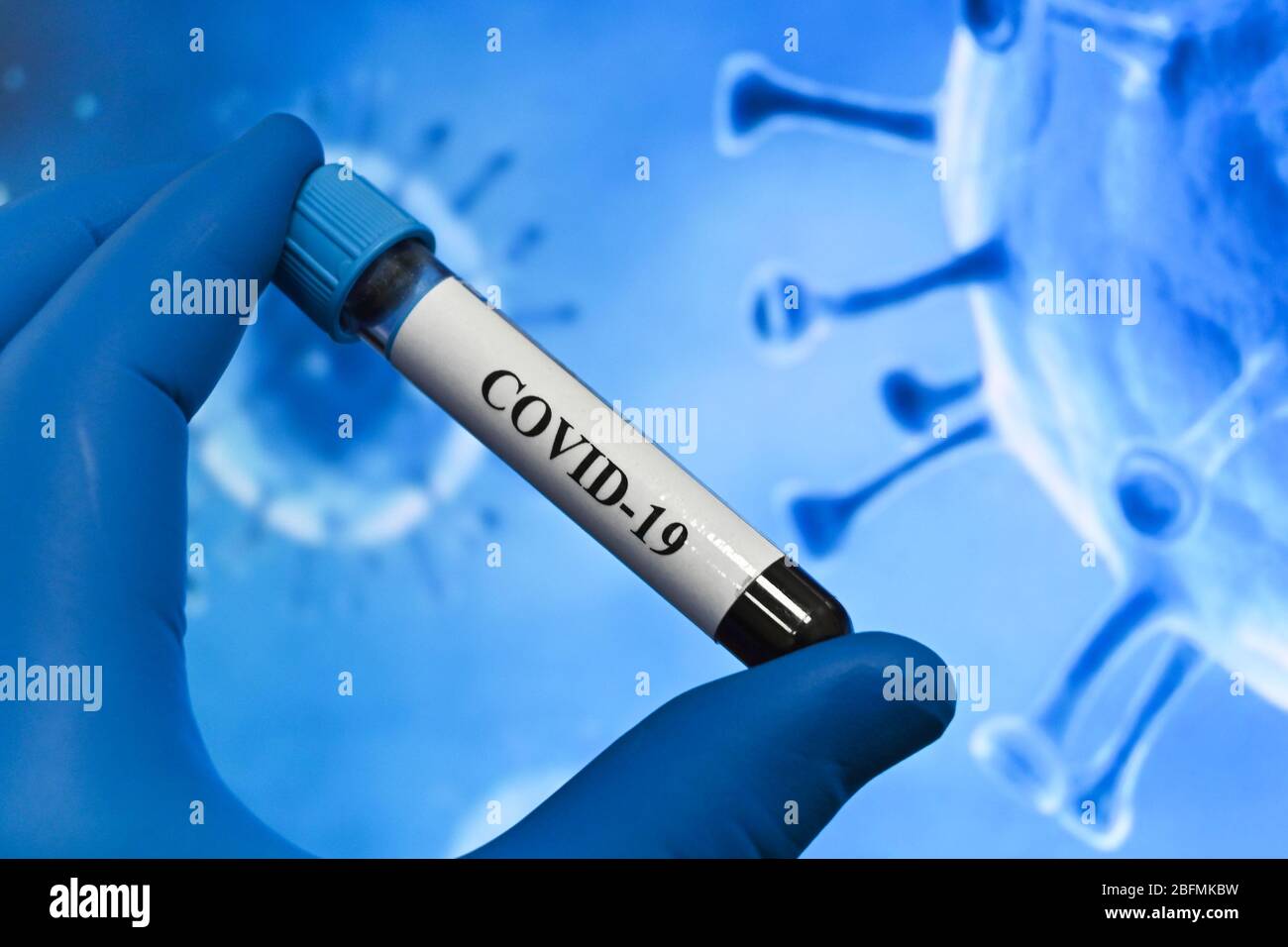 Individuazione del coronavirus, patogeno della malattia COVID-19. Provetta per analisi del sangue per analisi SARS-cov-2. Foto Stock