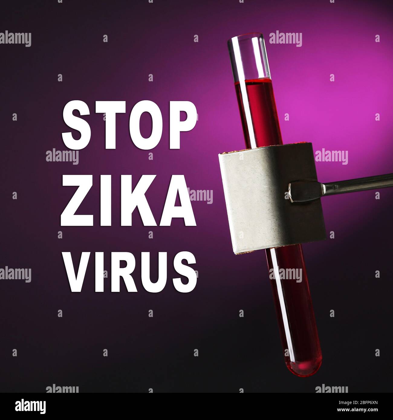 Concetto di pericolo del virus Zika. Interrompere il testo del virus zika con il campione di sangue nella provetta, primo piano. Foto Stock