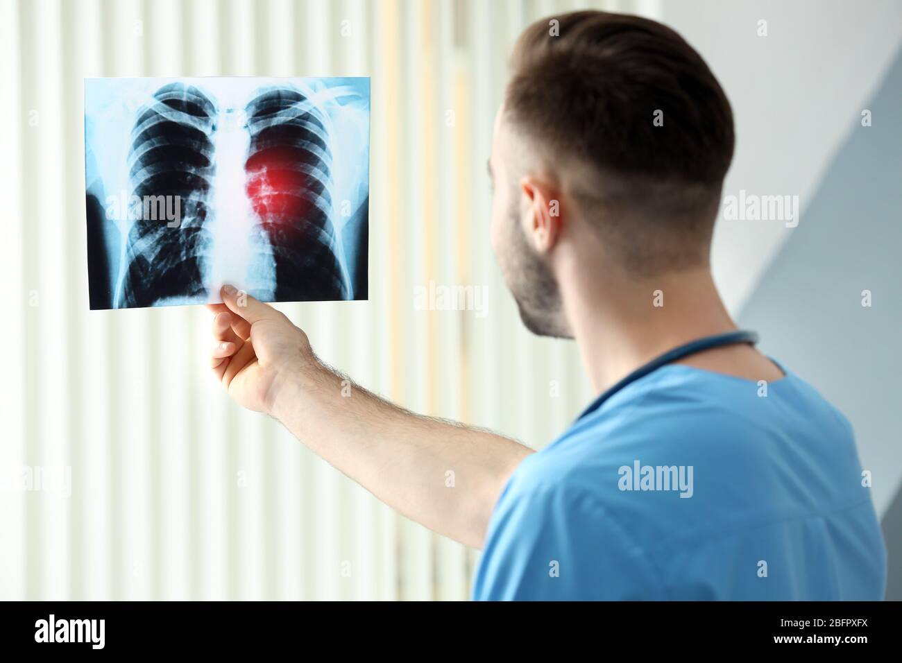 Medico con immagini radiografiche in ospedale. Concetto di cancro polmonare Foto Stock