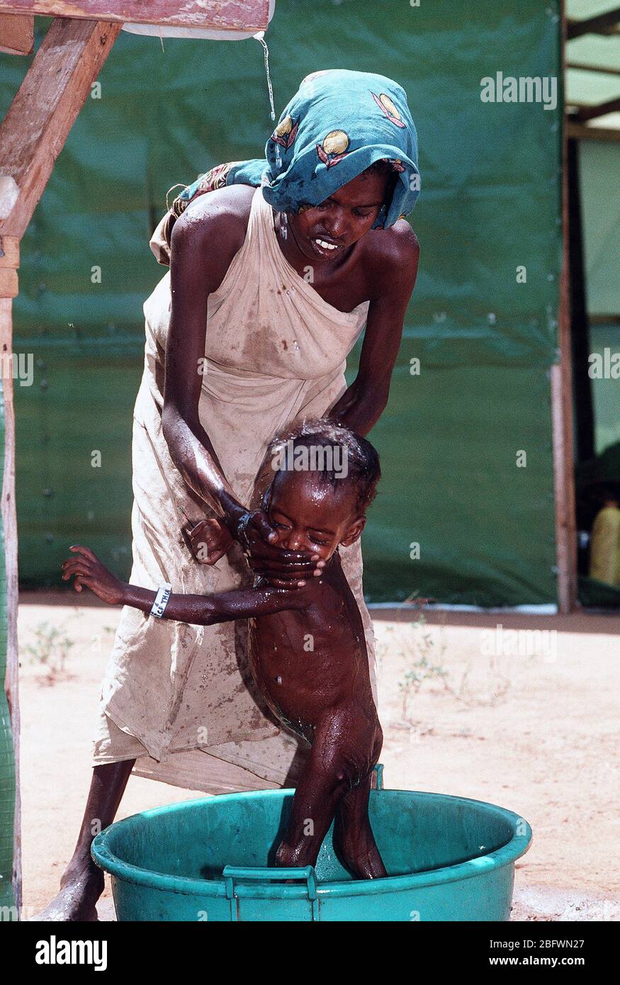1993 - un somalo madre bagna il suo bambino in una stazione di aiuti istituito durante il funzionamento ridare speranza i soccorsi. Foto Stock