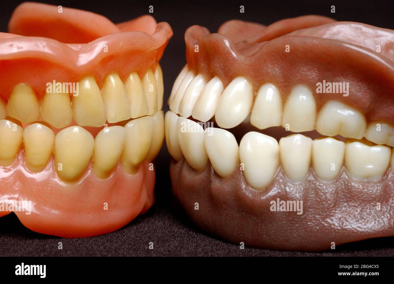 Due serie di protesi complete. Dentature o falsi denti sono realizzati con  una base acrilica sulla quale sono montati denti acrilici o ceramici. Le  dentiere sono ma personalizzati Foto stock - Alamy