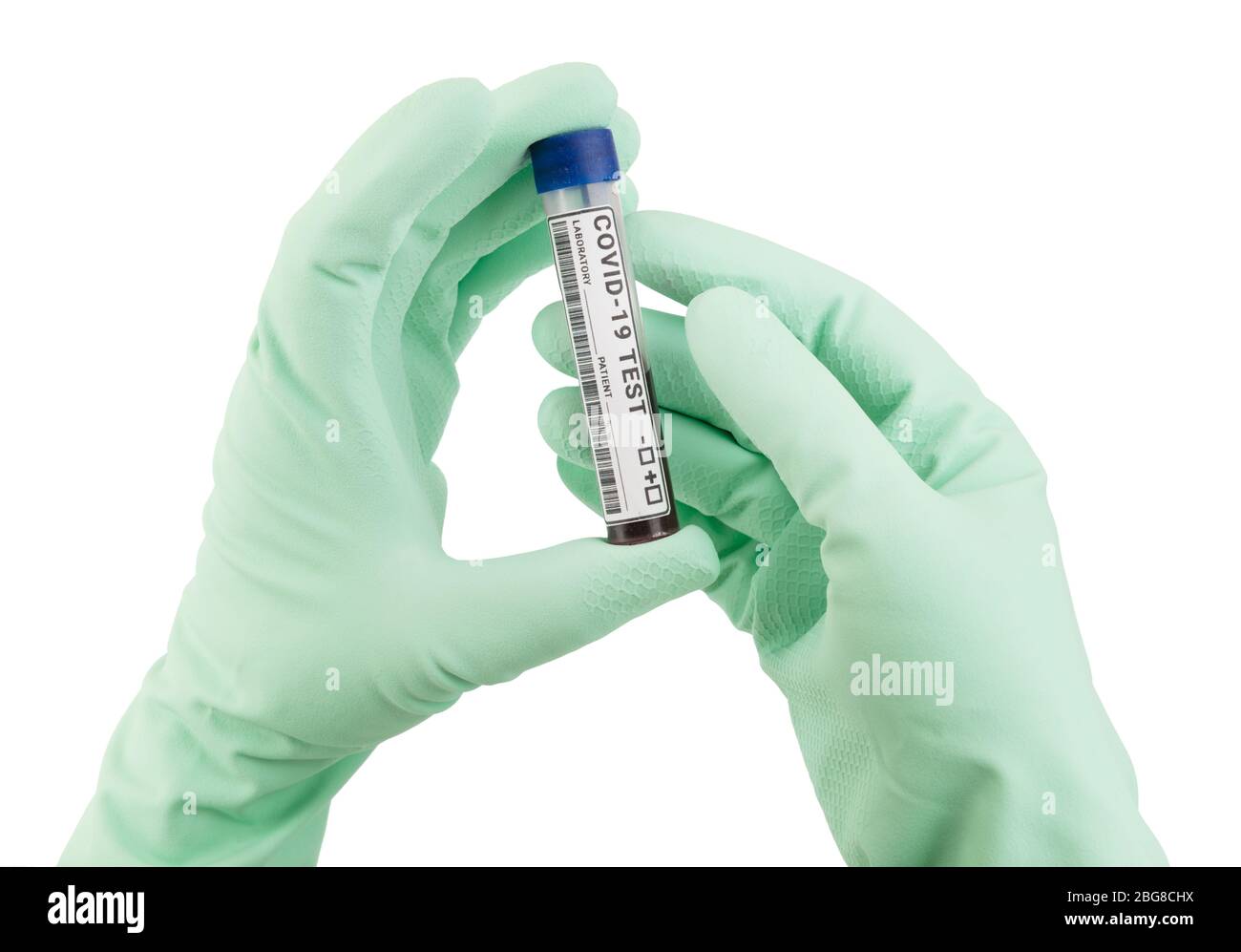 Le mani del medico nei guanti tengono una provetta con un campione di sangue per il test del coronavirus. Foto Stock