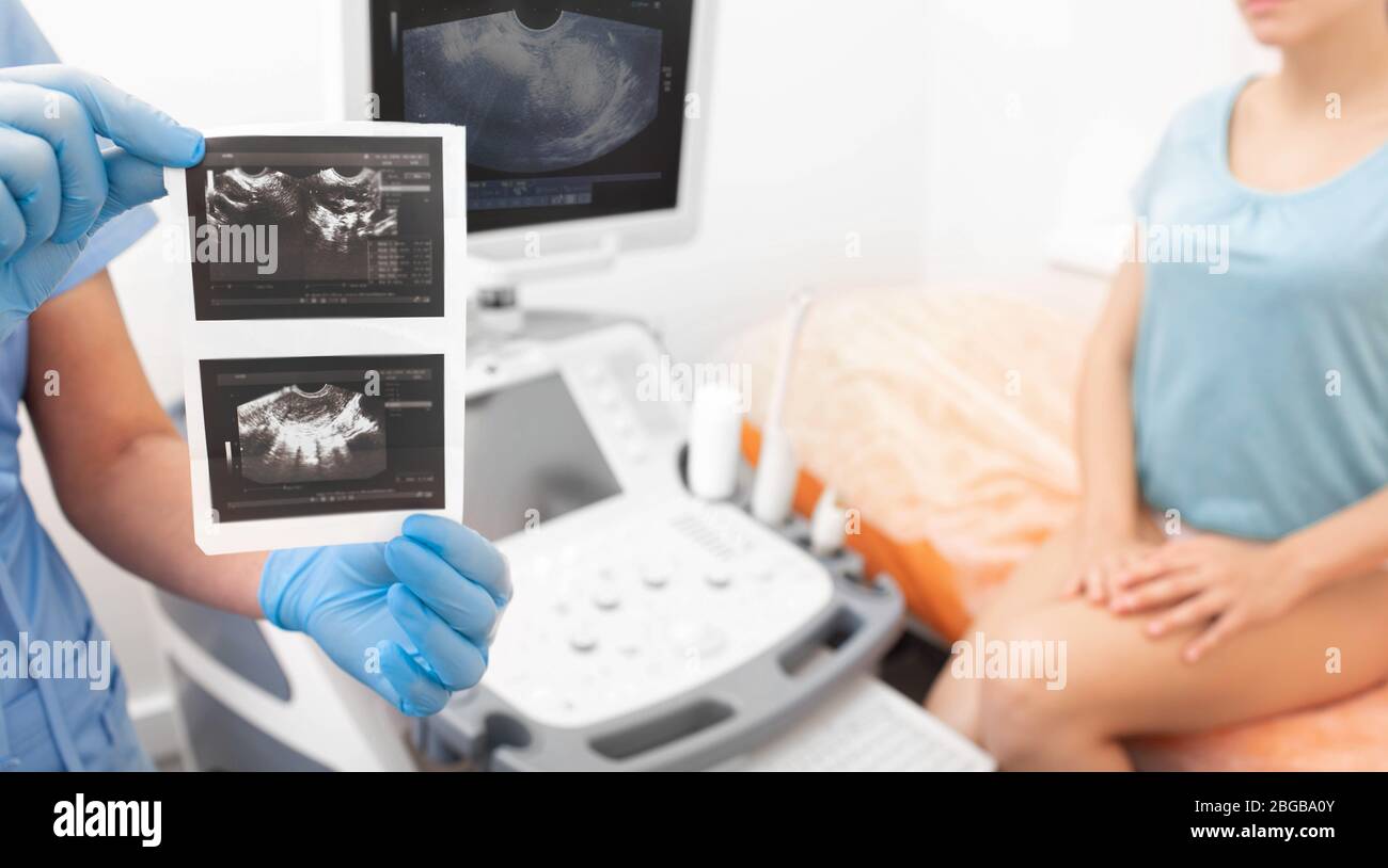medico che tiene in mano i risultati di un'ecografia transvaginale delle ovaie. Ginecologia Foto Stock
