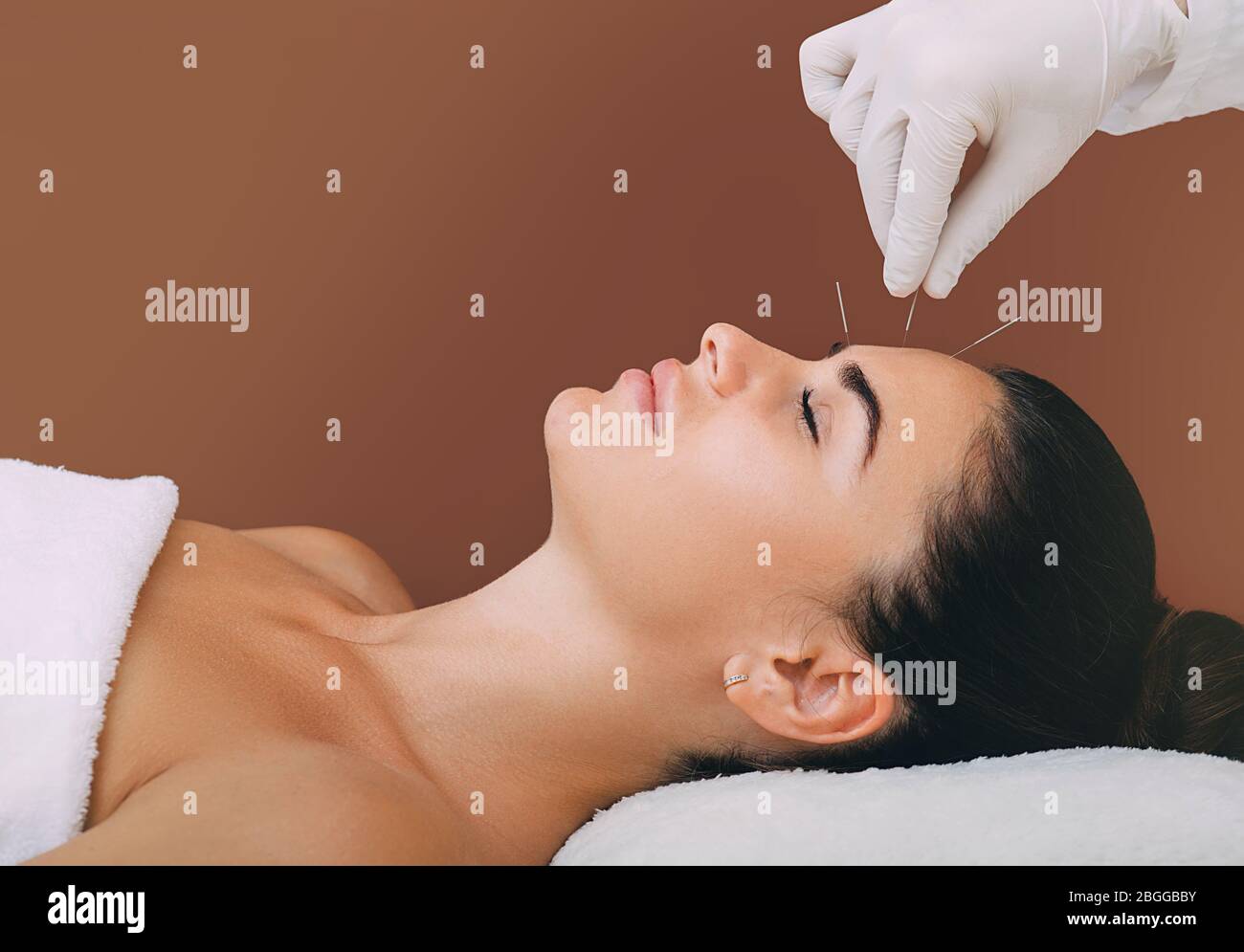 Trattamento di agopuntura per alleviare lo stress e rilassare il corpo. L'agopuntura è una medicina tradizionale cinese Foto Stock