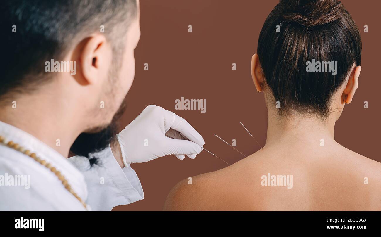Agopuncturist asiatico che fa agopuntura indietro per alleviare il dolore della spalla della donna. Medicina tradizionale cinese. Primo piano degli aghi per agopuntura Foto Stock