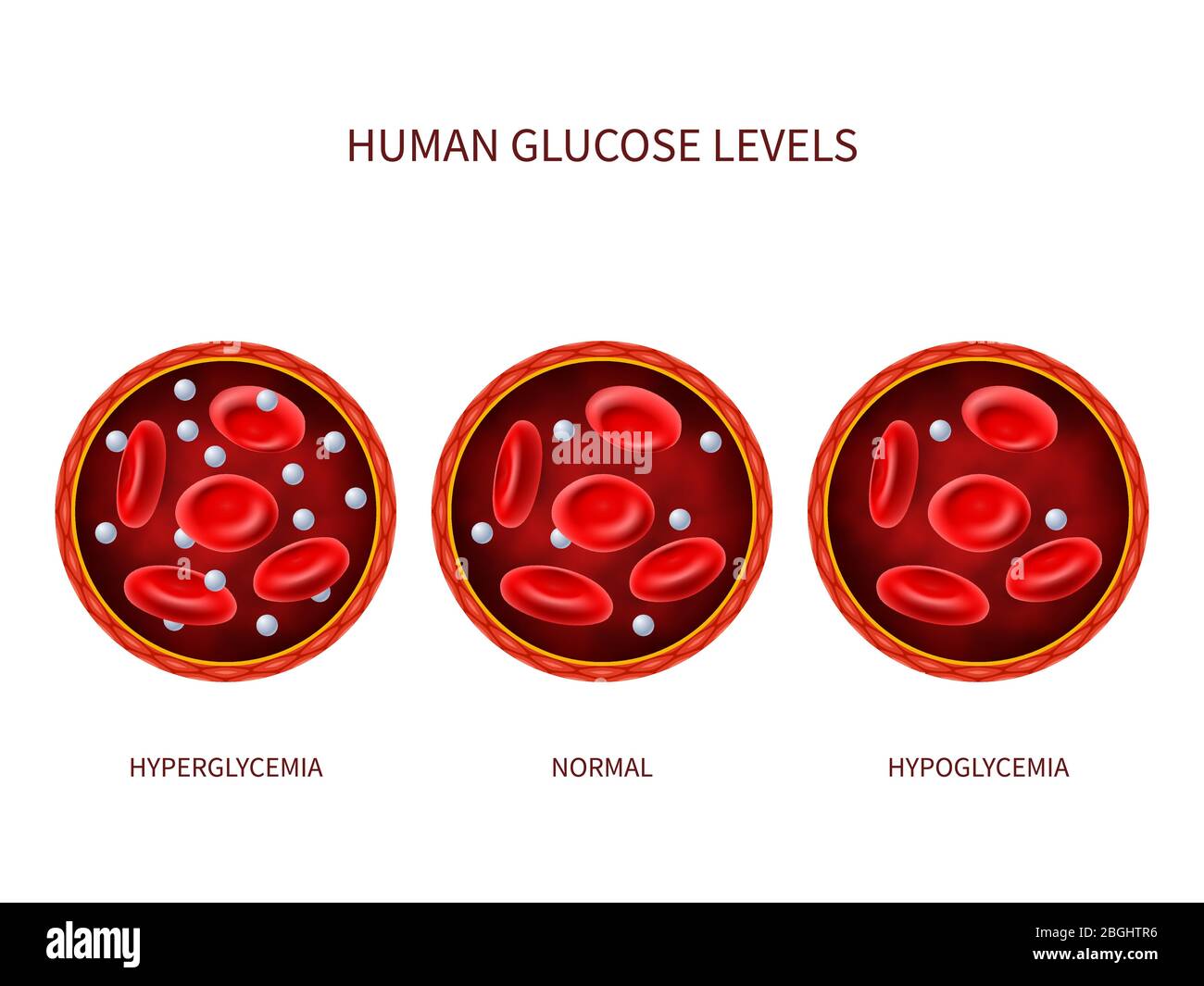 Livelli di glucosio nell'uomo iperglicemia, normale, ipoglicemia. Diagramma vettoriale ematologico con vaso sanguigno, eritrociti e zucchero. Illustrazione della malattia diabetica, diagnostica della malattia Illustrazione Vettoriale