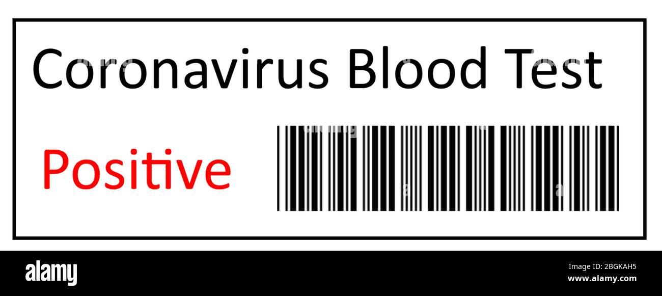 Test per analisi del sangue COVID-19, test per coronavirus. Scrittura su provetta con risultati positivi e negativi per coronavirus Covid-19. Foto Stock