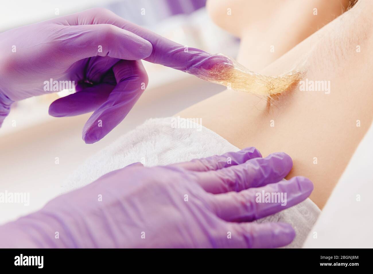 Applicazione di pasta di zucchero liquida alla donna depilazione della pelle del sottobraccio. Concetto di bellezza zuccherante Foto Stock