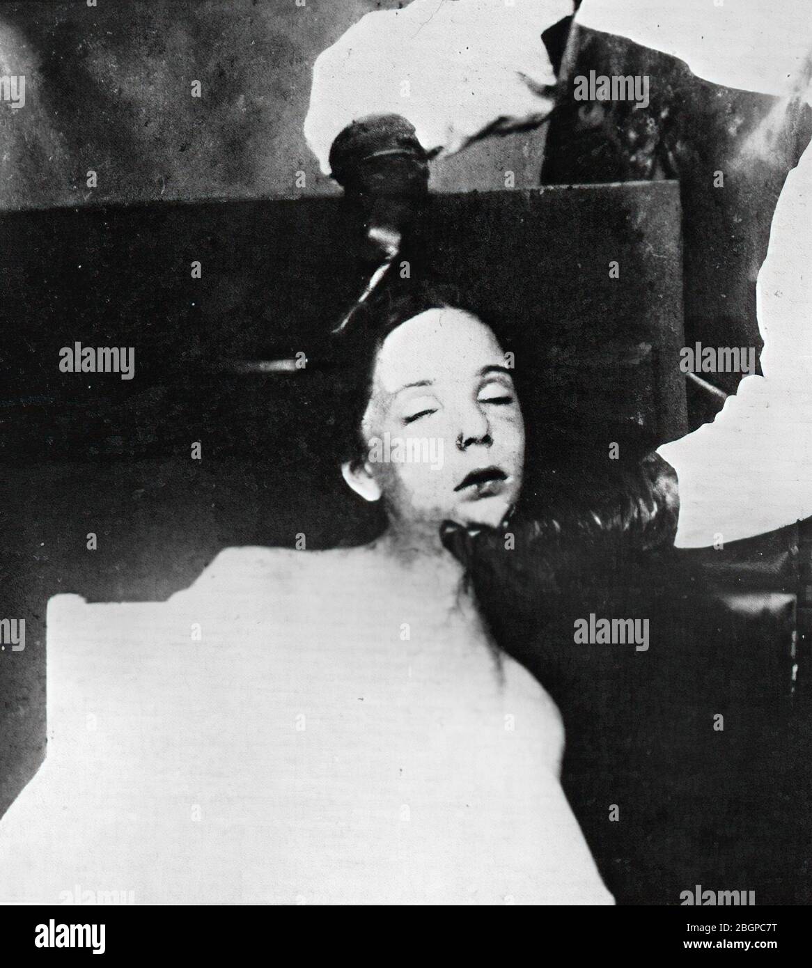 Helga Goebbels, morta a 12 anni, fu avvelenata dai suoi genitori insieme ai suoi cinque fratelli nel bunker di Hitlerâ€™il 1 maggio 1945 - qui dopo l'autopsia a Berlin_Buch Foto Stock