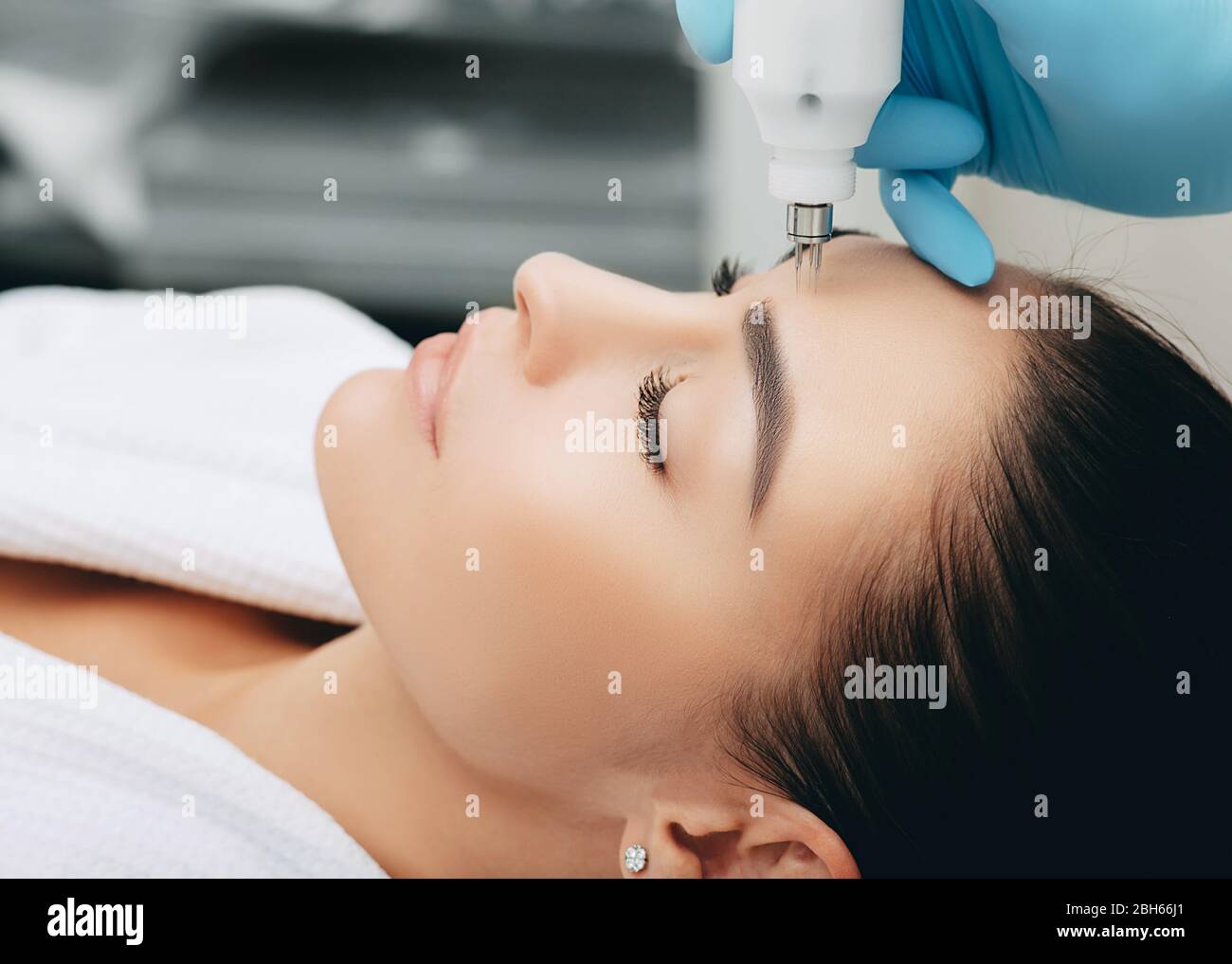 Procedura di rinnovo di pelle , no-ago alta frequenza mesoterapia Foto Stock
