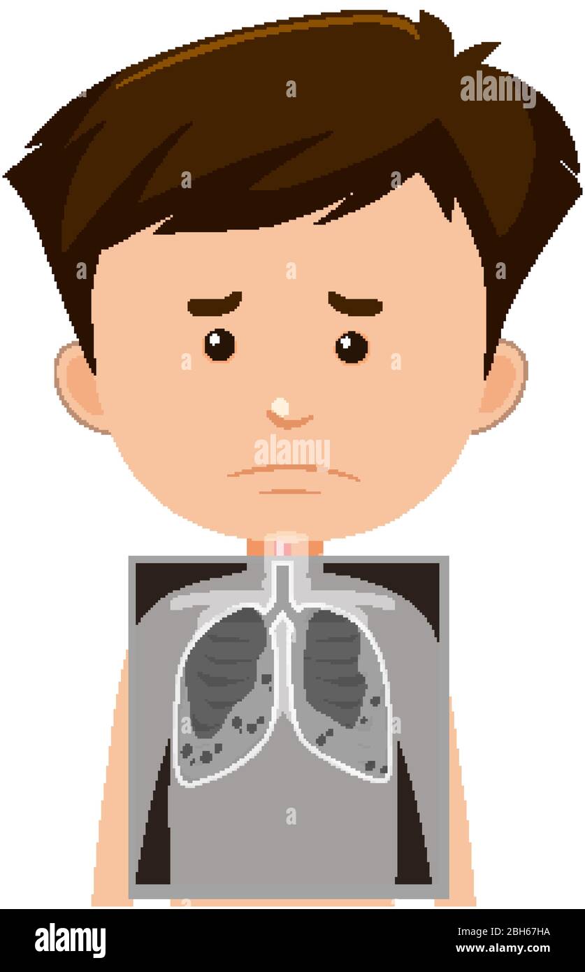 Maschio con i polmoni, illustrazione a raggi X. Illustrazione Vettoriale