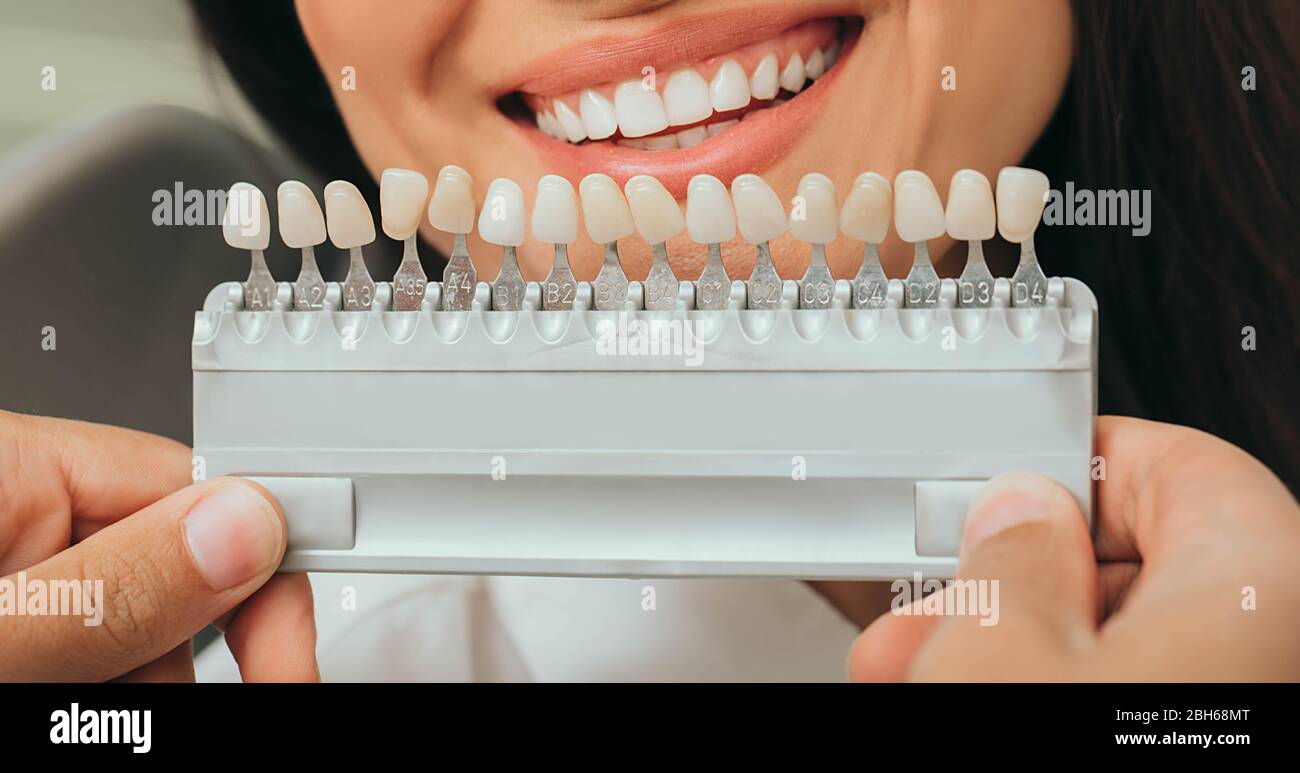 tavolozza denti con diverse sfumature di denti vicino femmina sorridente. Stomatologia, sbiancamento dei denti, impianto dentale Foto Stock