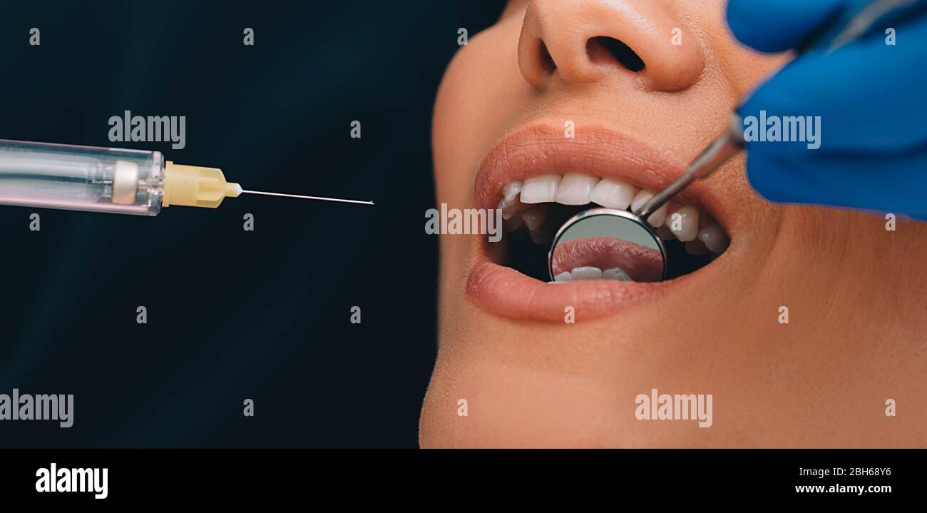 procedura denti anestesia ,macro. Trattamento dei denti senza dolore.siringa con anestesia vicino ai denti Foto Stock