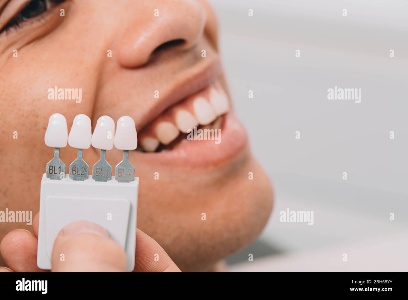 Dentista campionamento sfumature denti, tiene denti tavolozza sfumature vicino bocca maschio. Denti sbiancanti Foto Stock