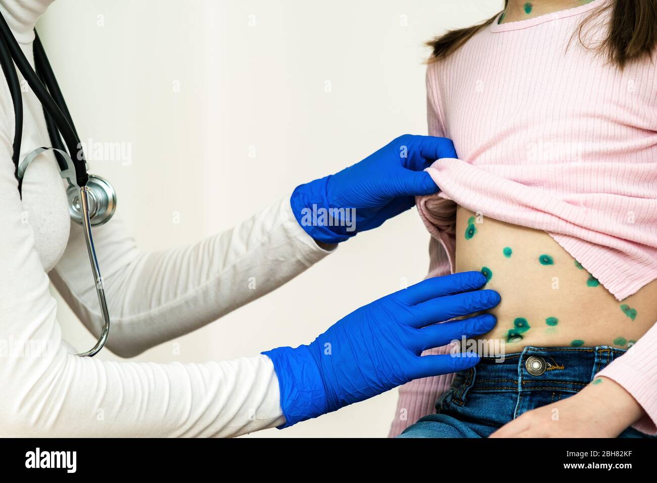 Medico che esamina un bambino coperto di eruzioni verdi su stomaco malato con varicella, morbillo o rosolia virus. Foto Stock