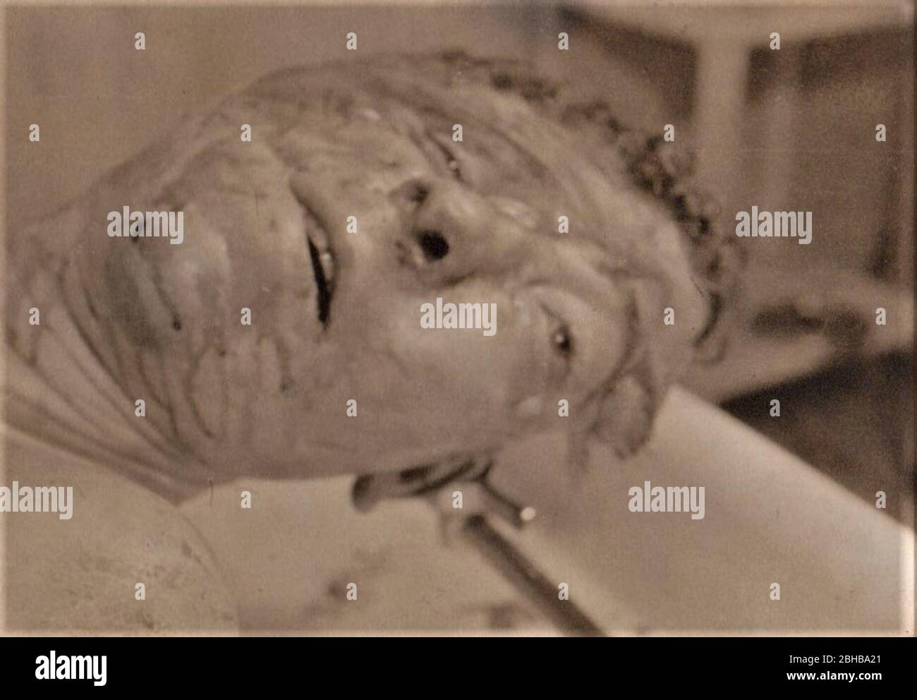 Vittima del campo di concentramento di Buchenwald Foto Stock