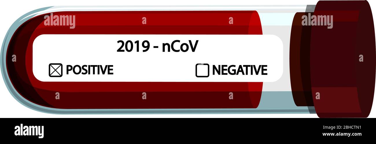 Illustrazione vettoriale piatta della provetta per il controllo del coronavirus COVID-19 con segni di spunta positivi e negativi. Provetta con campione di sangue per COVID-19. Test positivo per il nuovo Coronavirus a rapida diffusione. Illustrazione Vettoriale