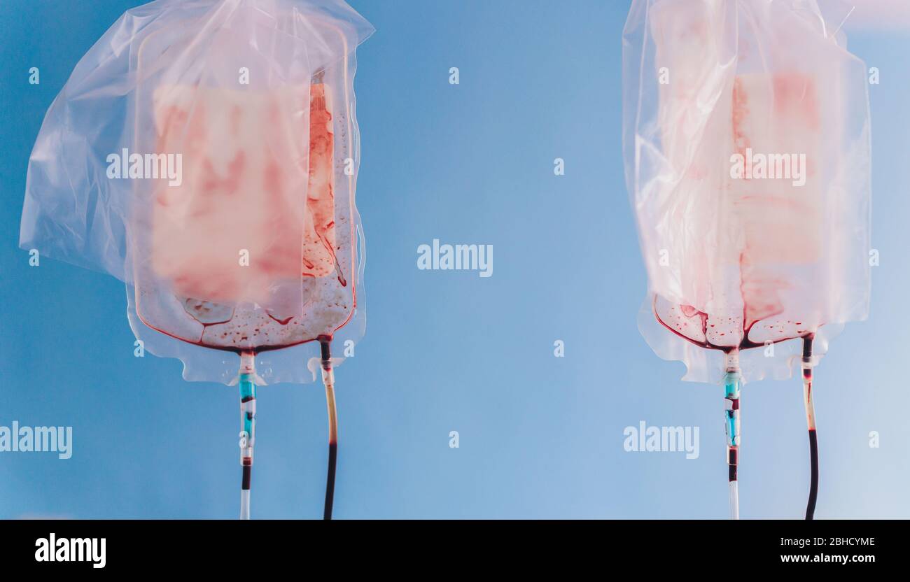 una sacca di sangue per infusione in un centro clinico. viene somministrato il sangue del donatore Foto Stock