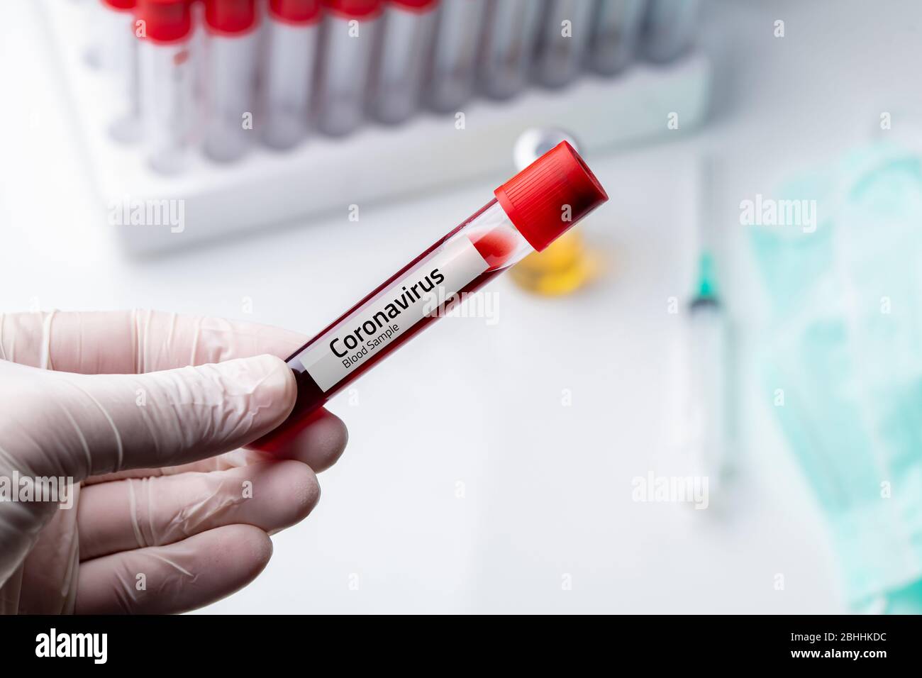Medico che indossa guanti medici che tengono una provetta per il sangue con campione di sangue positivo Coronavirus 2019-nCoV. Foto Stock