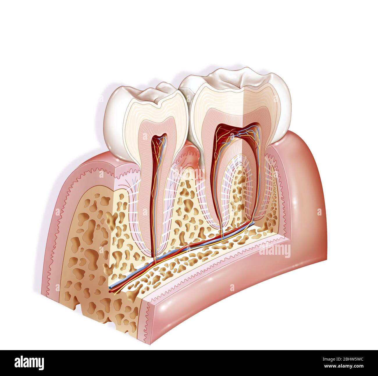 Tasca periodontale, patologia dentale. La tasca periodontale è uno spazio che si crea tra il dente e la gengiva durante la malattia periodontale. IT Foto Stock