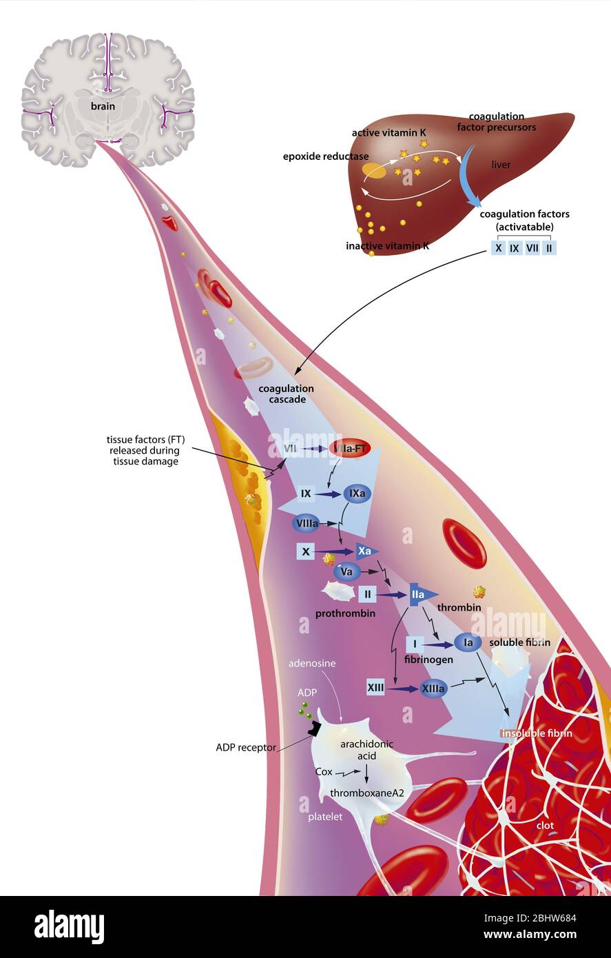 Ictus e antitrombici. In alto a sinistra, il cervello nella sezione frontale con la sua vascolarizzazione. Uno zoom di un vaso sezionale parte dal cervello a det Foto Stock