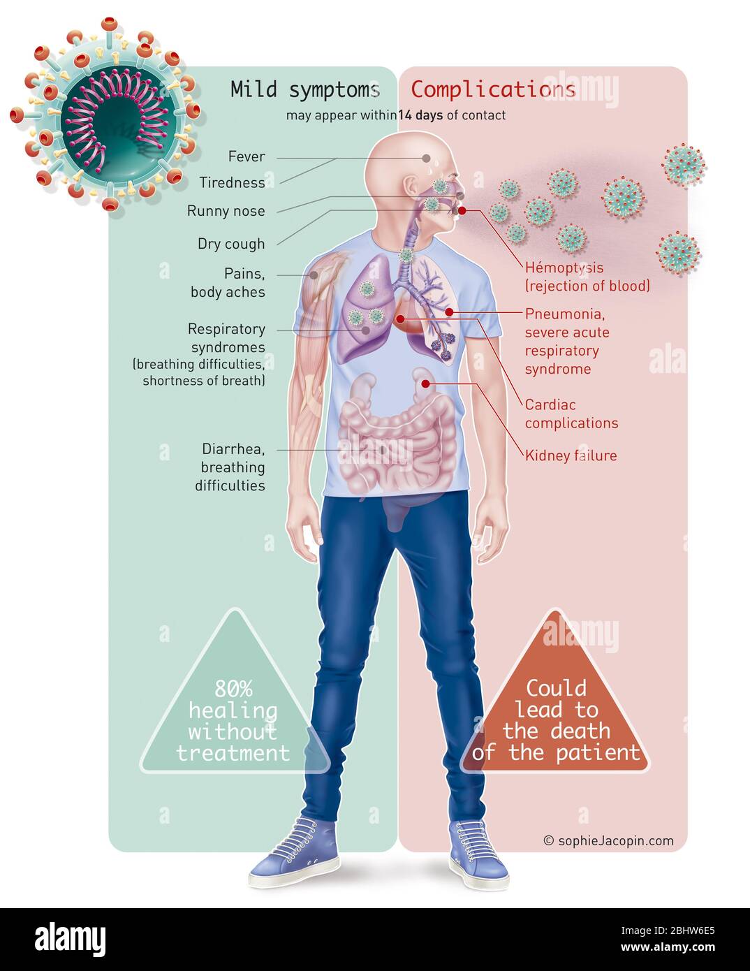 Prevenzione dei sintomi del coronavirus, CoVid-19, SARS-COV2, pandemia 2020. CoVid-19 ha iniziato una pandemia nel 2020. Il virus responsabile di questa malattia di Th Foto Stock