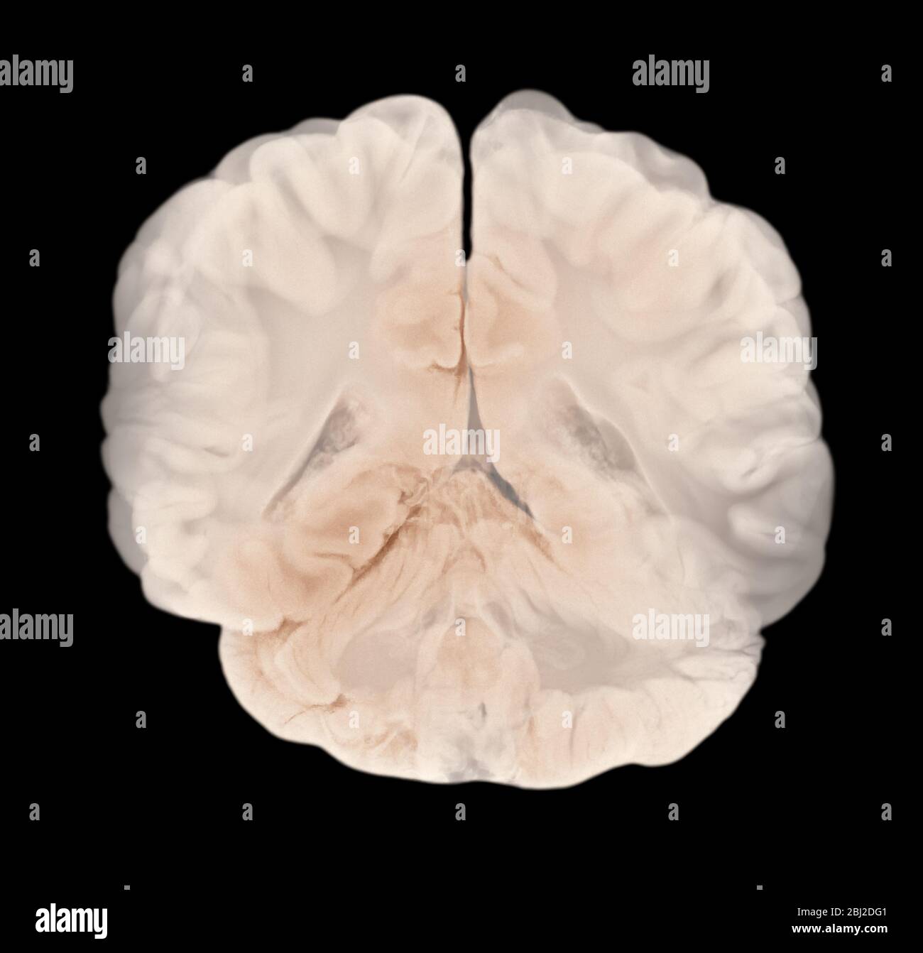 Sezione verticale attraverso emisferi cerebrali. Anatomia cerebrale umana Foto Stock
