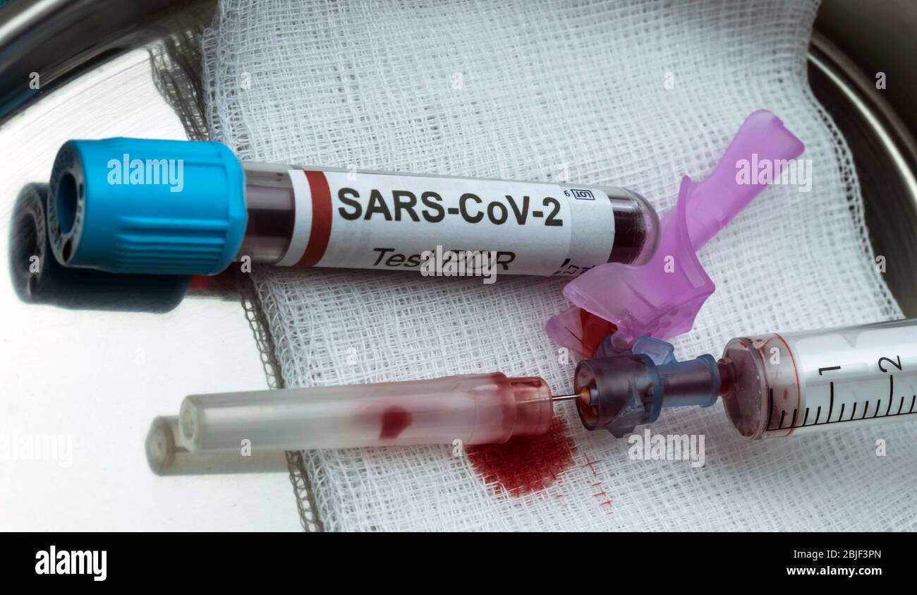 siringa per sangue con vaccino covid-19, idea concettuale Foto Stock