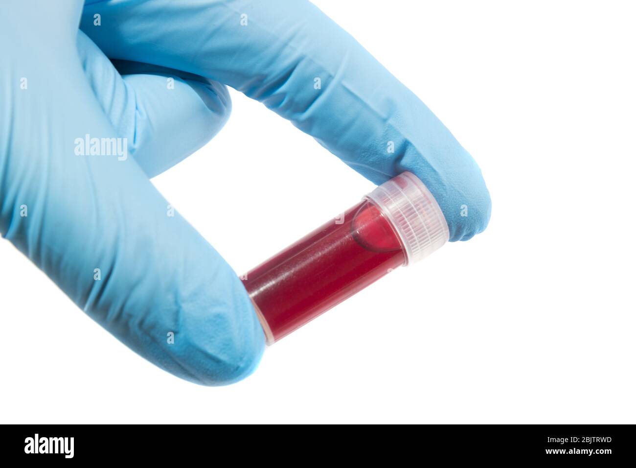Provetta per analisi del sangue in una mano medica con guanti medici blu. Foto Stock