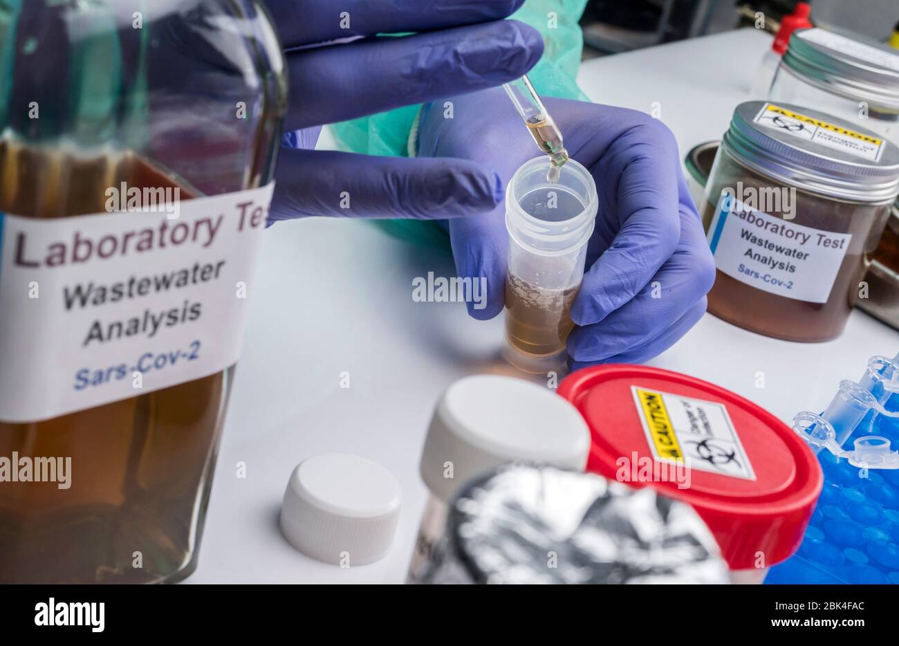 Analisi scientifica del campione di acque reflue in laboratorio, indagine di possibile contaminazione da parte di Sars-Cov-2 nell'uomo, immagine concettuale Foto Stock