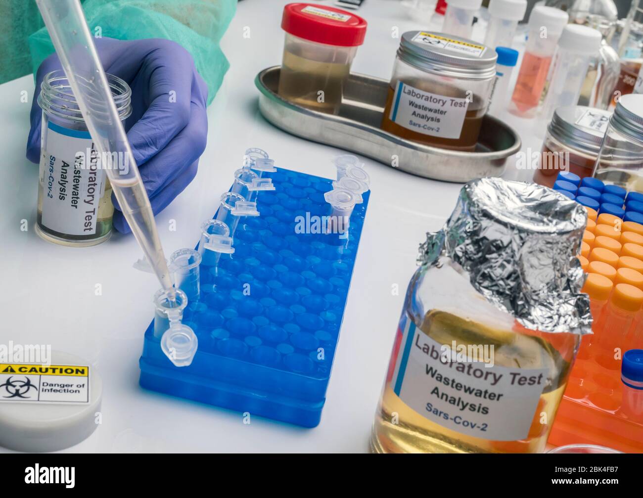 Analisi scientifica del campione di acque reflue in laboratorio, indagine di possibile contaminazione da parte di Sars-Cov-2 nell'uomo, immagine concettuale Foto Stock