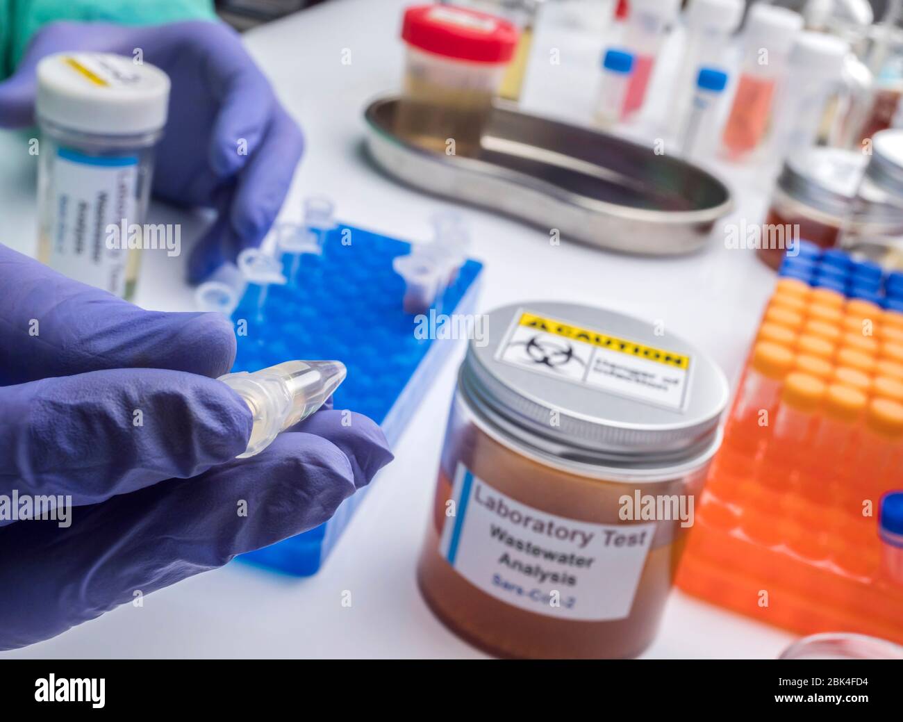 Analisi scientifica del campione di acque reflue in laboratorio, indagine di possibile contaminazione da parte di Sars-Cov-2 nell'uomo, immagine concettuale Foto Stock