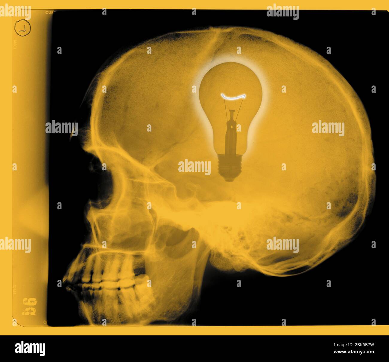 Cranio umano con lampadina, raggi X colorati. Foto Stock