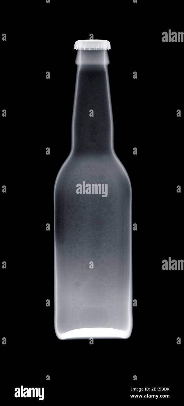 Bottiglia di birra, raggi X. Foto Stock