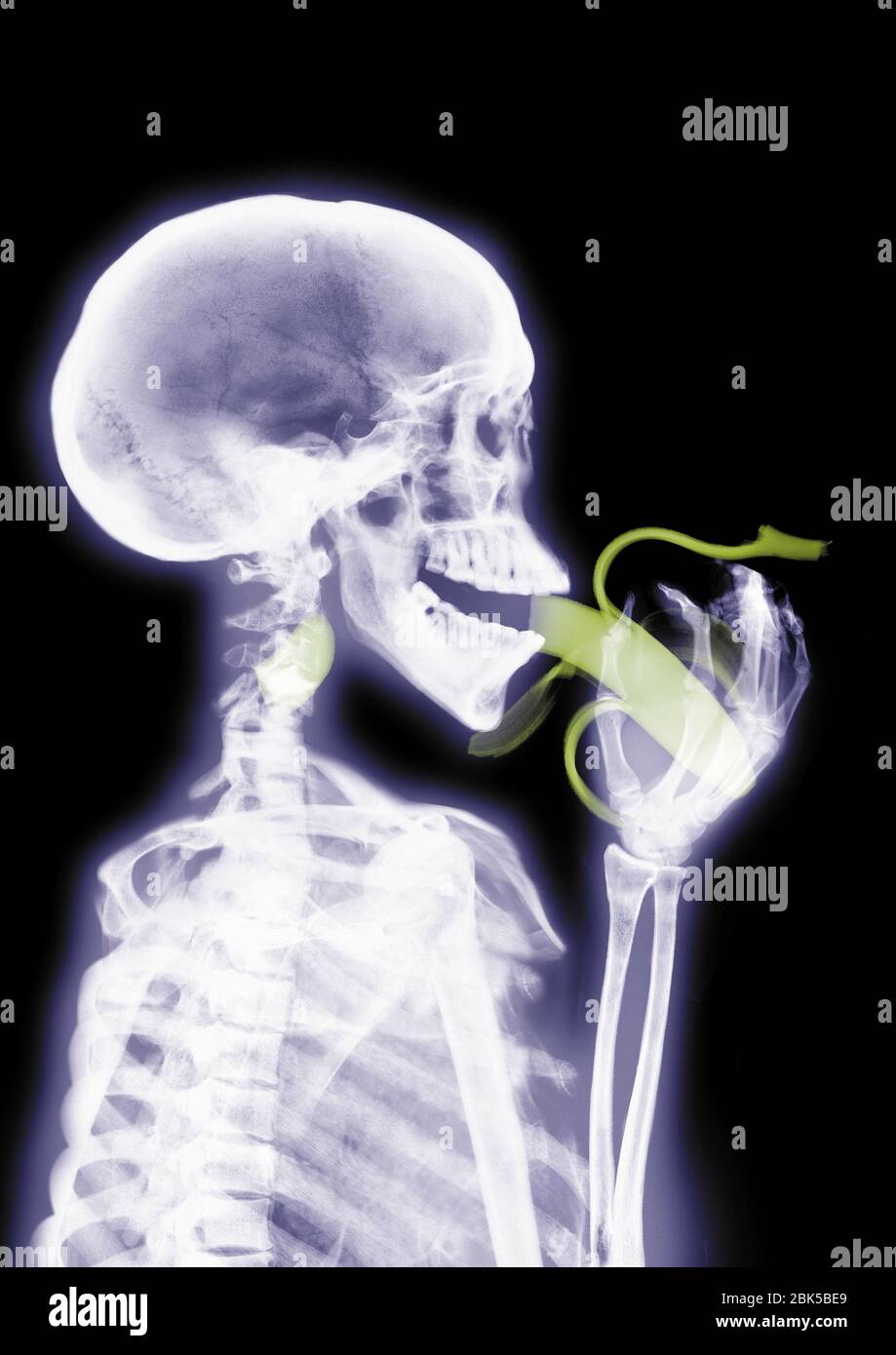 Persona che mangia una banana, raggi X colorati. Foto Stock