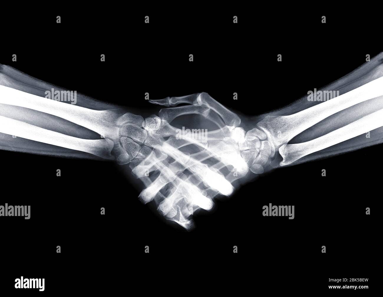 Stretta di mano, raggi X. Foto Stock