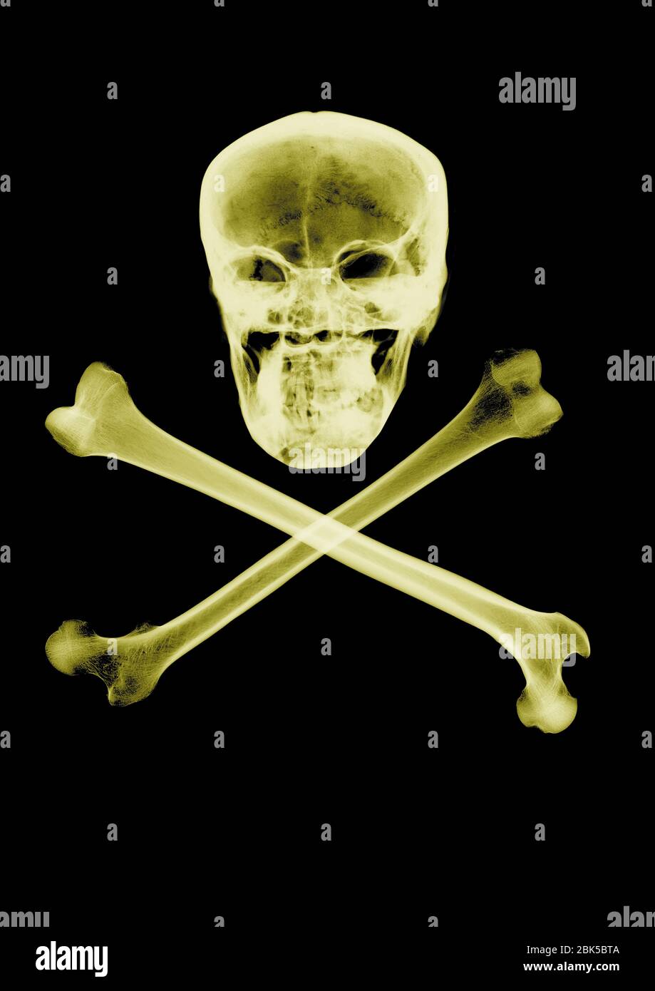 Cranio e crossbones, raggi X colorati. Foto Stock